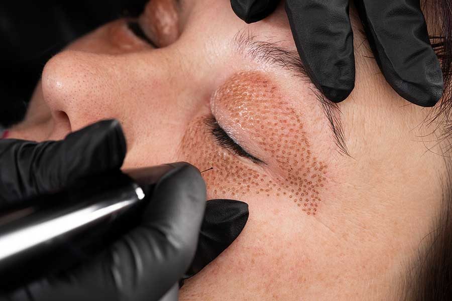 Microblading the brow with a hand tool